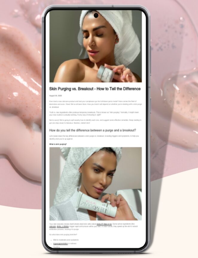 MD Glam 'Skin Purging vs. Breakout' article, displayed on a cell phone.