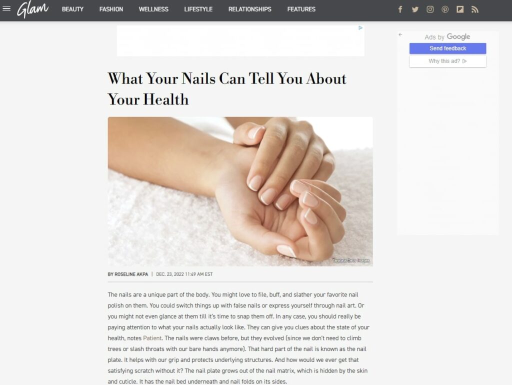 A nail blog post idea from Glam about what your nails can tell you about your health